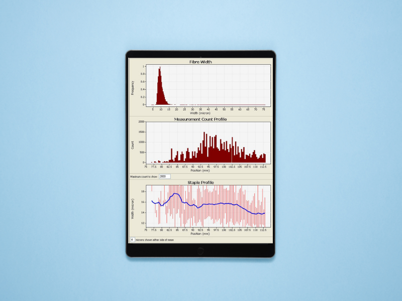 Tablet showing the FibreScan grapgh interface