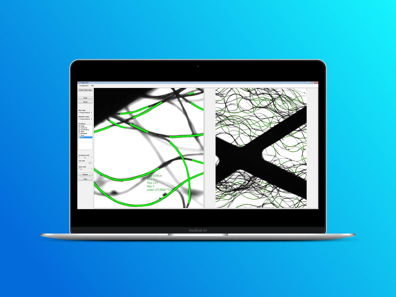 Laptop with the image of Fibrescan analysis tool on the screen